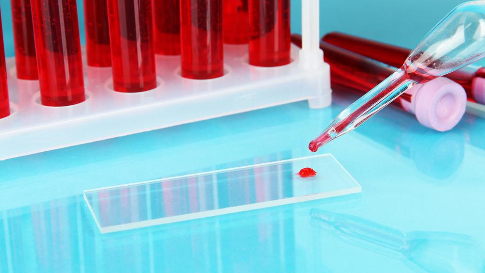 Just a Drop of Blood is All This Device Needs to Instantly Diagnose Asthma